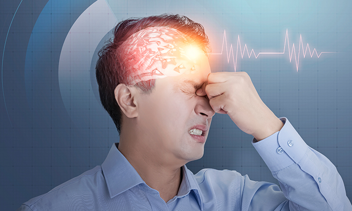 뇌혈관질환이미지